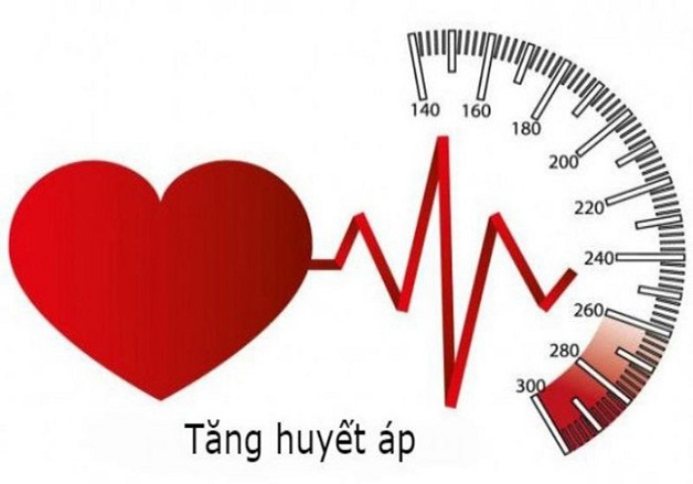 Tăng huyết áp là một trong những nguyên nhân gây thiêu máu não