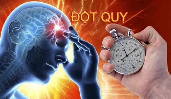 Tăng huyết áp tâm trương có thể dẫn tới đột quỵ