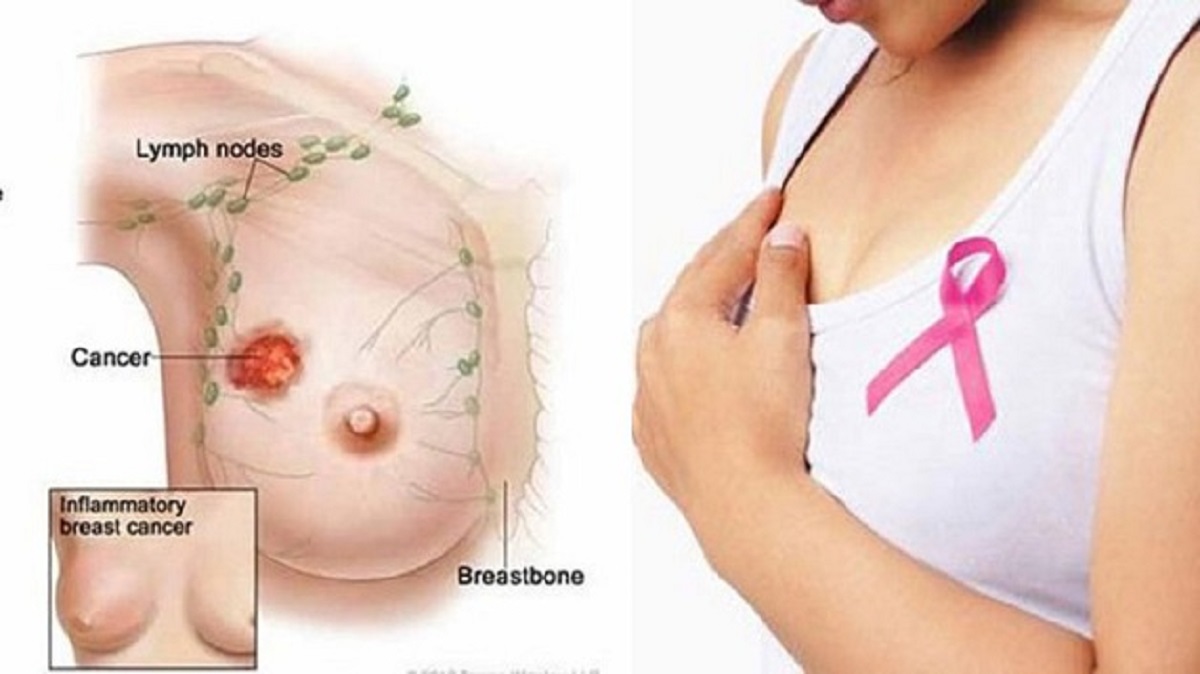 Đau ngực sau đau ngực sau sinh và cách chăm sóc sức khỏe
