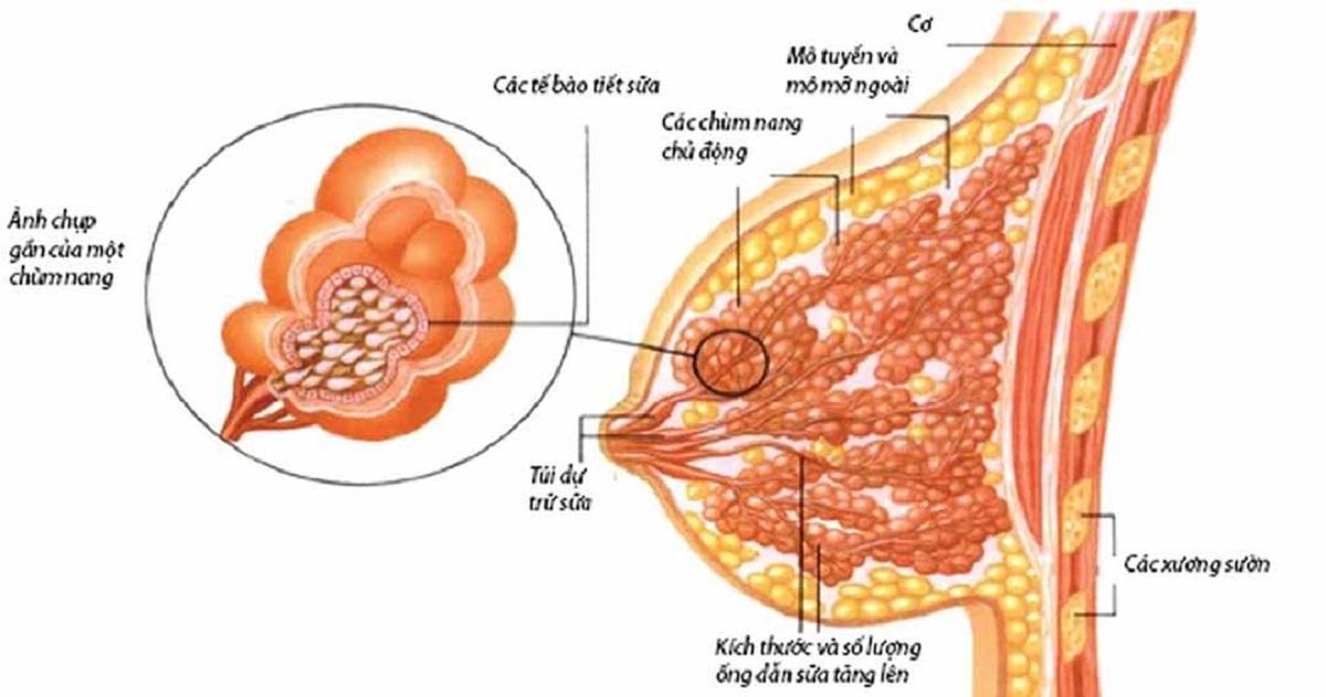 Phương pháp chẩn đoán u nang tuyến vú là gì?
