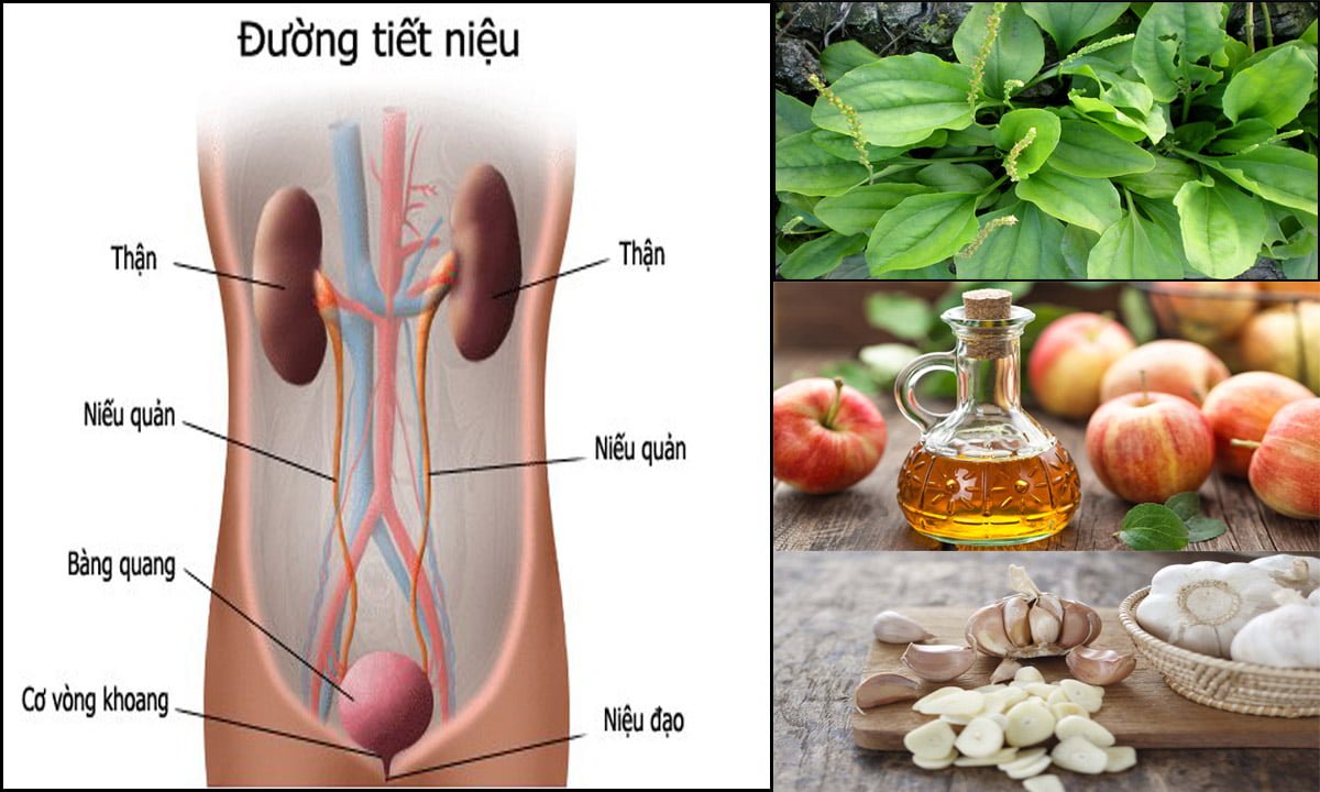 Triệu chứng của viêm đường tiết niệu là gì?
