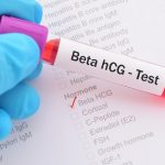 Góc giải đáp: Xét nghiệm beta HCG có ý nghĩa như thế nào? 