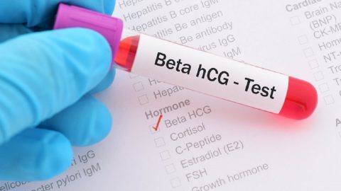Góc giải đáp: Xét nghiệm beta HCG có ý nghĩa như thế nào? 