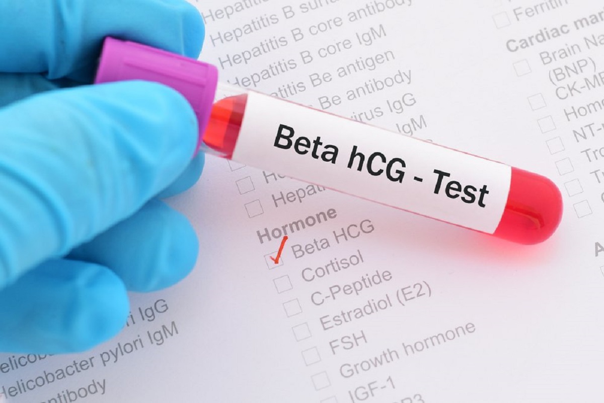 Kết quả xét nghiệm Beta HCG trong trường hợp có thai sớm và có thai muộn có khác nhau không?
