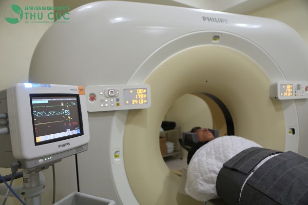 chụp ct giúp chẩn đoán thiếu máu não