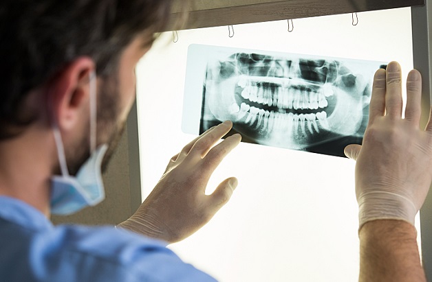 Thăm khám, chụp phim X-quang kiểm tra tình trạng mất răng
