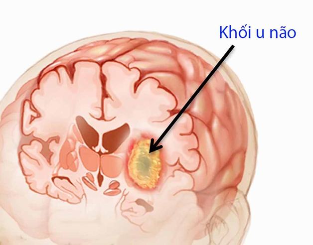 4. Khi nào nên gặp bác sĩ?