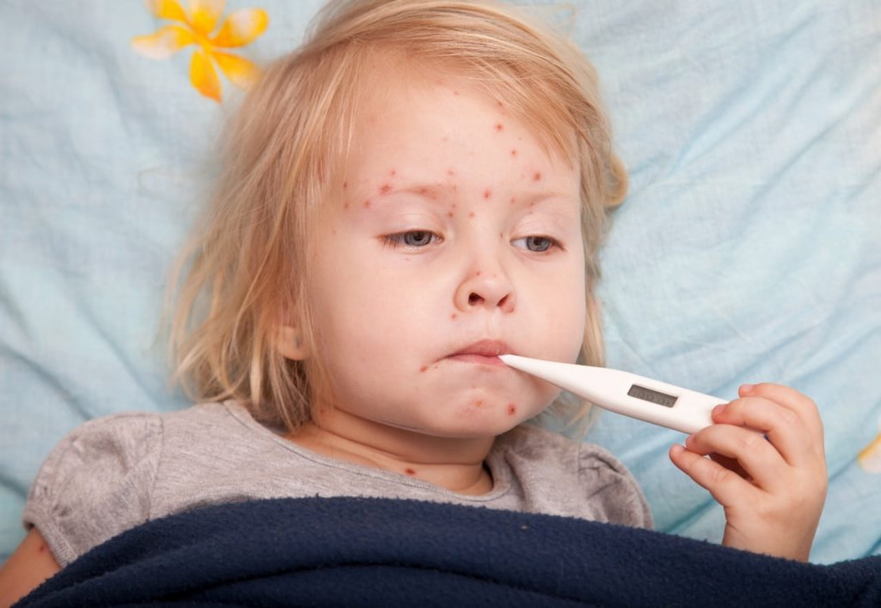 Có thể lây bệnh sốt siêu vi qua ho, hắt hơi, sổ mũi không?
