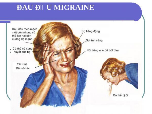 đau nửa đầu migraine
