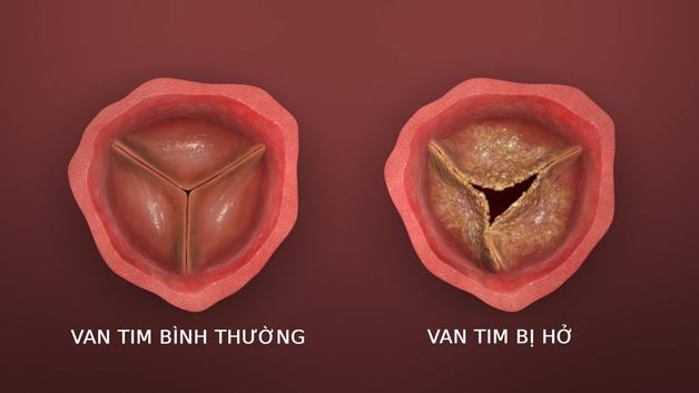 Tổng Quan Về Nong Van Tim