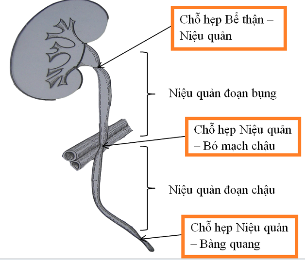 phau thuat tao hinh nieu quan