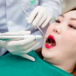 Răng số 8 có nên nhổ không? Có những phương pháp nhổ răng nào?