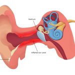 Những dấu hiệu viêm tai ngoài và điều trị thế nào hiệu quả?