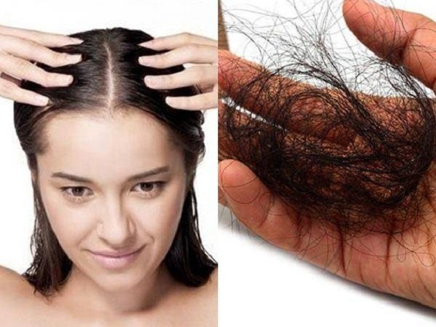 Tóc rụng nhiều mỗi lần gội Nguyên nhân và cách khắc phục  Vinmec