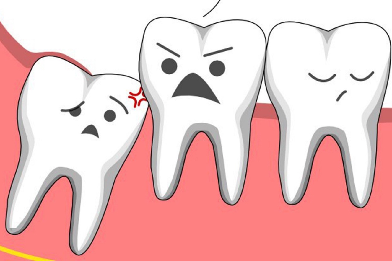 Phương pháp và công nghệ tiên tiến nhất hiện nay để nhổ răng khôn sau khi sinh con?
