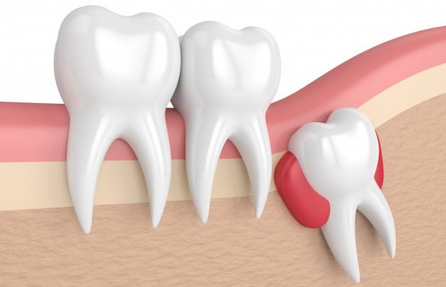 Quá Trình Mọc Và Phát Triển Của Răng Số 8