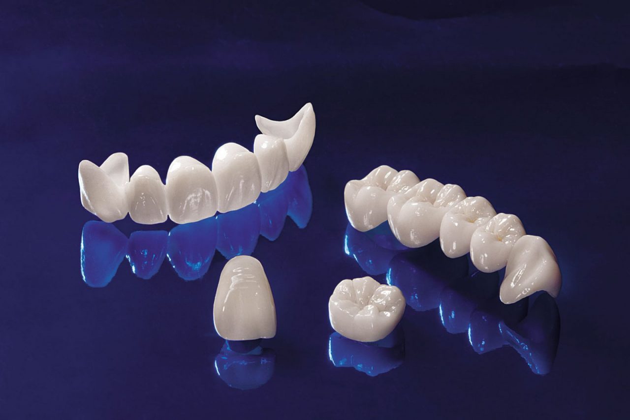 Răng sứ Cercon có tương thích với môi trường răng miệng không? 
