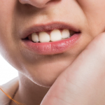 Tìm hiểu về bệnh viêm tủy răng có mủ: Nguyên nhân và cách điều trị