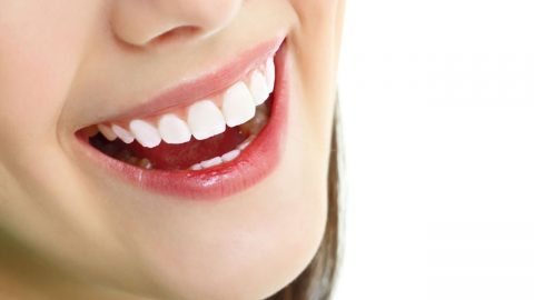 Tìm hiểu về phương pháp thẩm mỹ răng: Bọc sứ Cercon HT