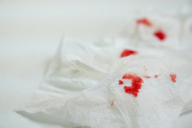 Máu đỏ tươi dính trên giấy vệ sinh sau khi lau