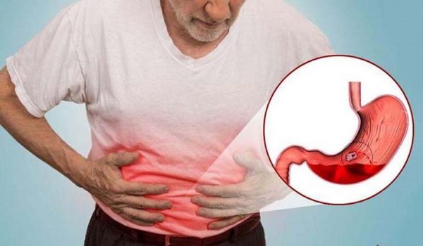 Xuất huyết tiêu hóa là gì? Nguyên nhân, triệu chứng là gì? Bệnh xuất huyết tiêu hóa là gì