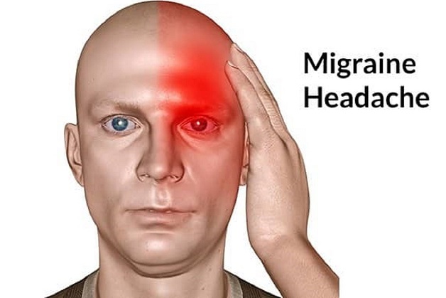 đau nửa trên đỉnh đầu do bệnh đau nửa đầu migraine