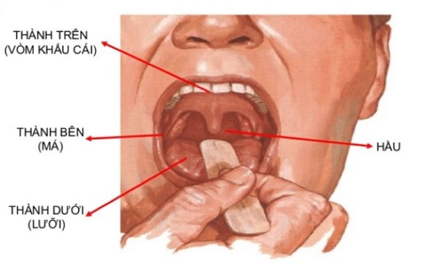 Điều trị bệnh lý khoang miệng | TCI Hospital