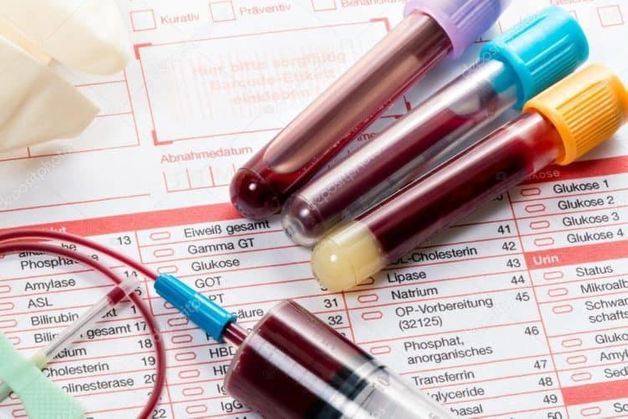 chi phí xét nghiệm sinh hóa máu