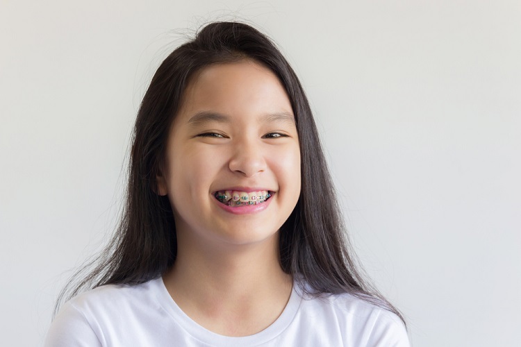 Khi nào cha mẹ cần niềng răng cho trẻ? | TCI Hospital
