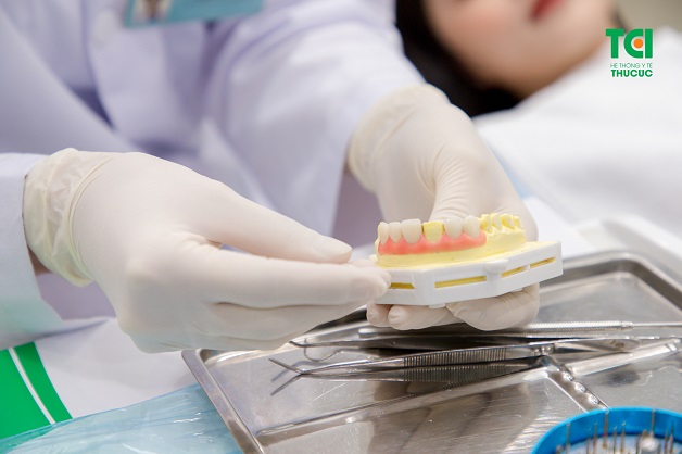 Phẫu thuật kéo dài thân răng là kỹ thuật điều chỉnh mô nướu và xương sao cho phù hợp để bộc lộ thân răng nhiều hơn.