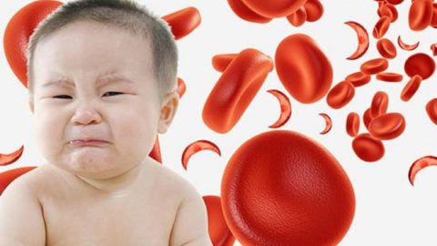 Tìm hiểu về căn bệnh thiếu máu não ở trẻ em