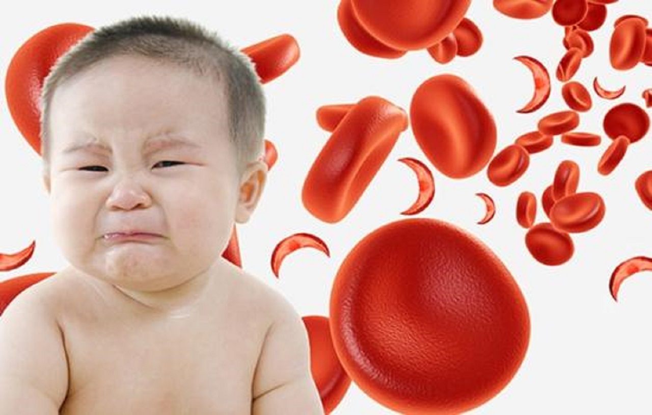 Включи анемия. Железодефицитная анемия у детей. Жда у детей. Жда у новорожденных детей. Железодефицитная анемия у новорожденных.