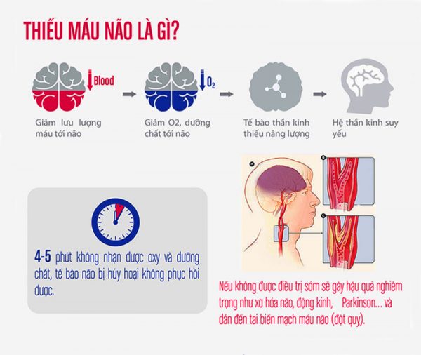 thiếu máu não có chữa được không