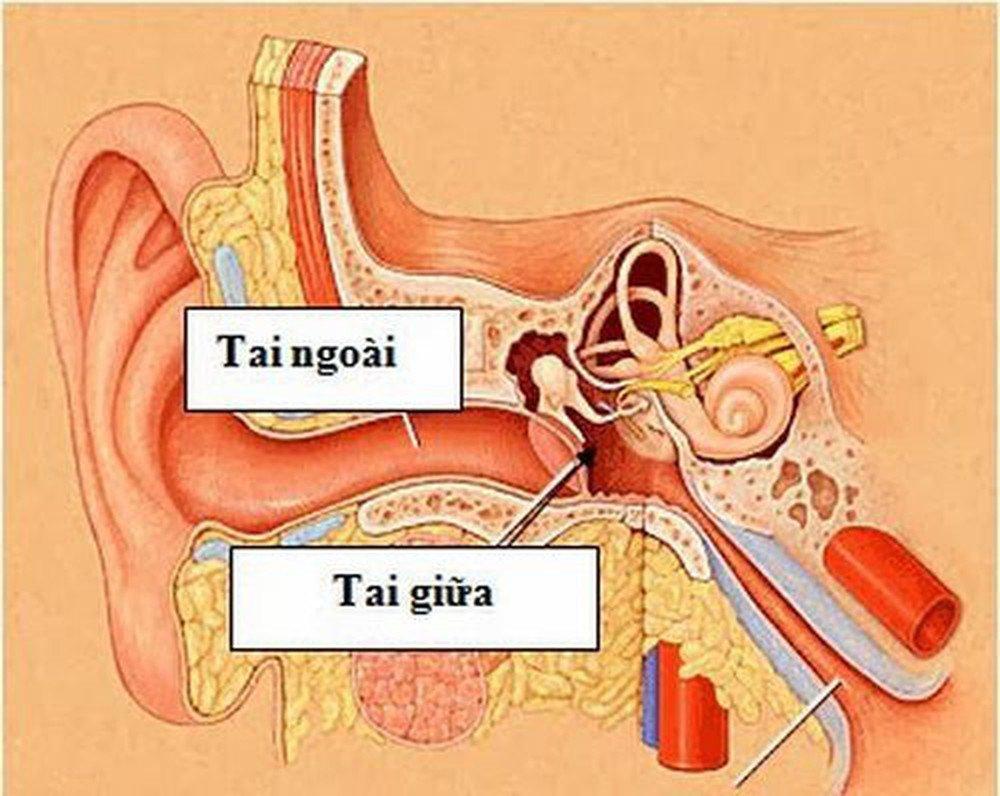 Viêm tai ngoài không chỉ là một bệnh