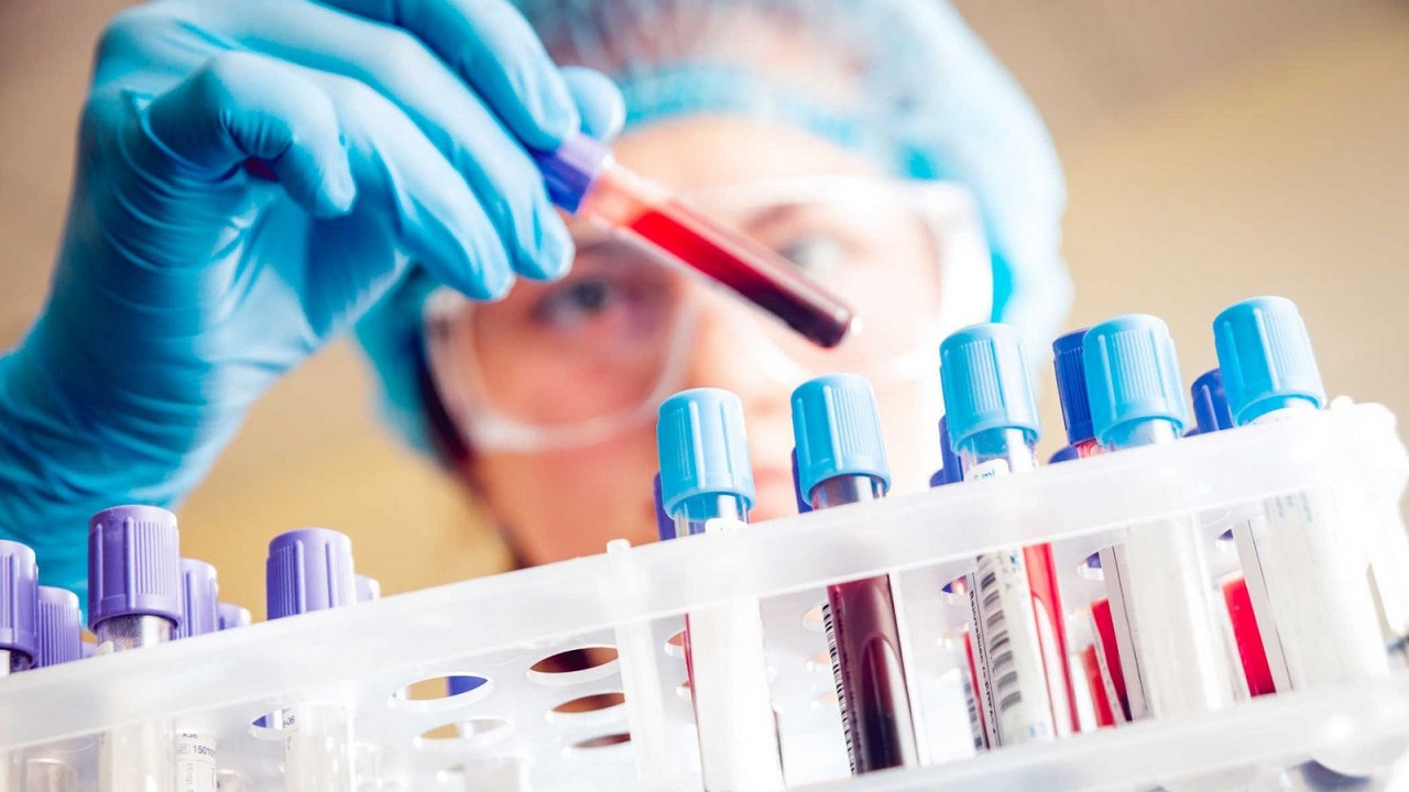 PCT là chỉ số gì trong xét nghiệm máu?
