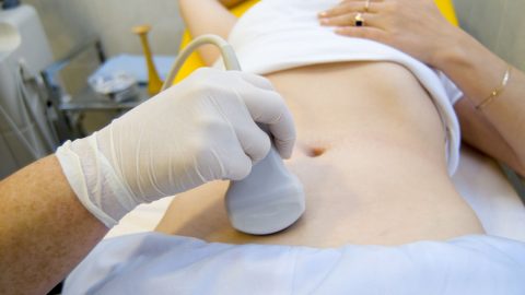 80% phụ nữ cần biết xét nghiệm u nang buồng trứng