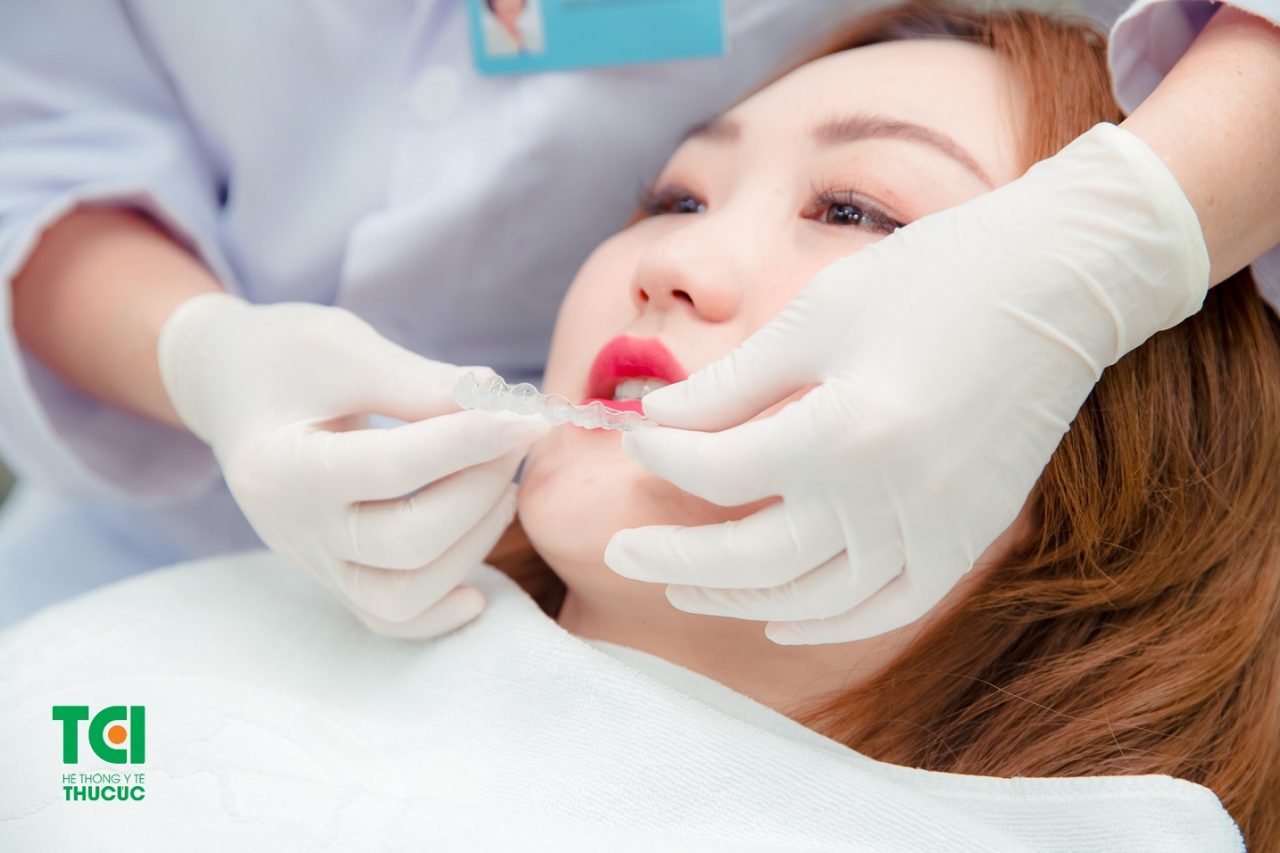Cách điều trị hiệu quả cho người mắc bệnh răng vổ là gì? 
