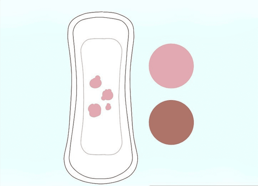 Máu báo thai màu gì, làm sao phân biệt với kinh nguyệt? | TCI Hospital