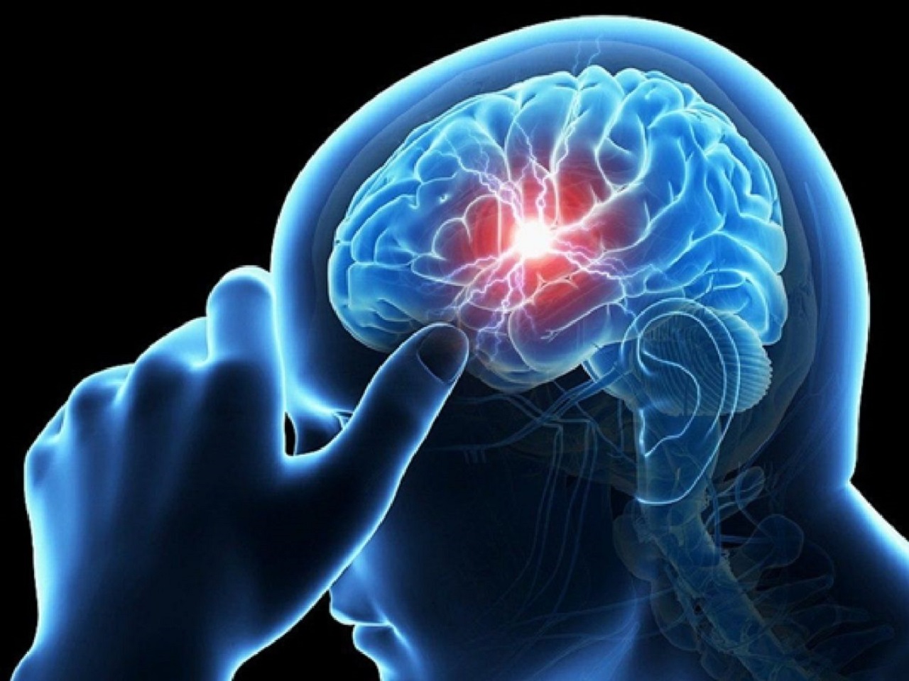 Tìm hiểu về thiếu máu não cục bộ Nguyên nhân và triệu chứng