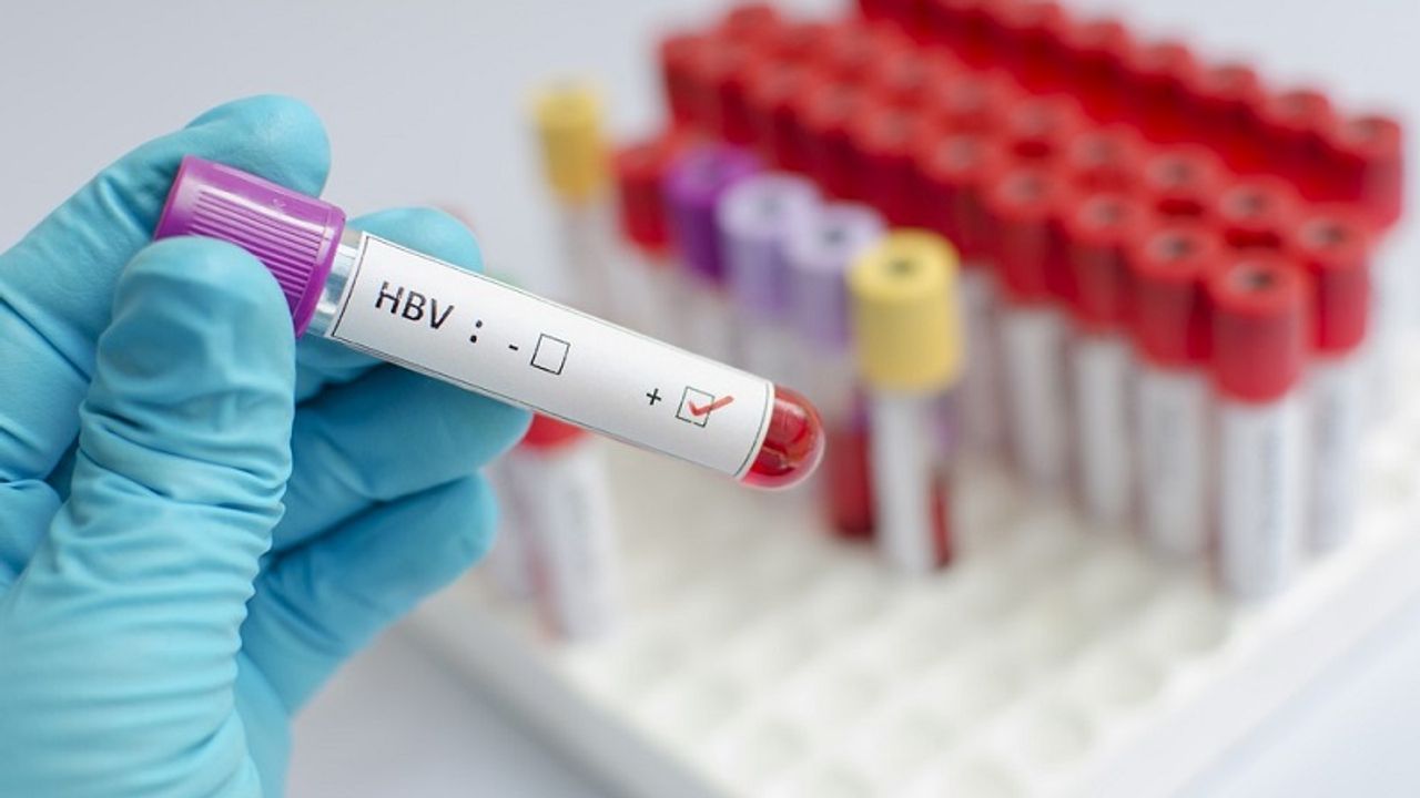 Xác định xét nghiệm hbsag định lượng là gì cho hiểu rõ bệnh viêm gan B