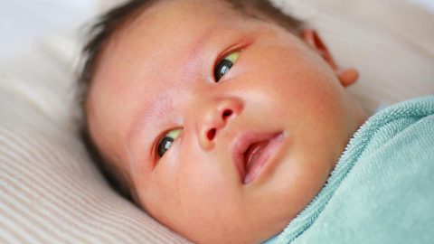Trẻ sơ sinh bị vàng da vàng mắt có đáng lo không?