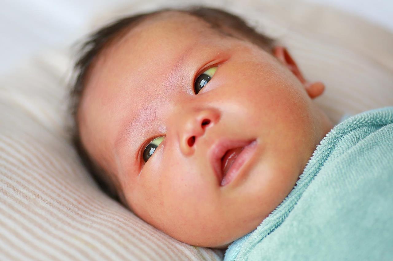 Trẻ sơ sinh bị vàng da vàng mắt có đáng lo không? | TCI Hospital