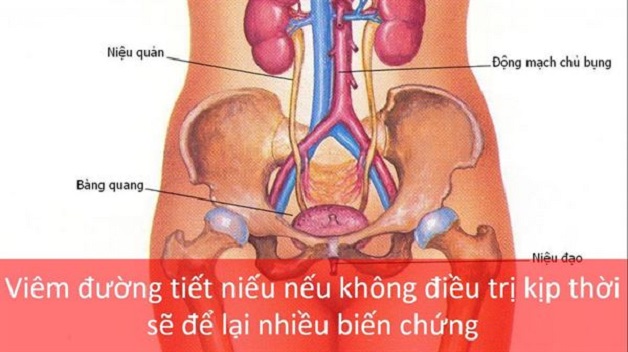 viem duong tiet nieu kham o khoa nao 3