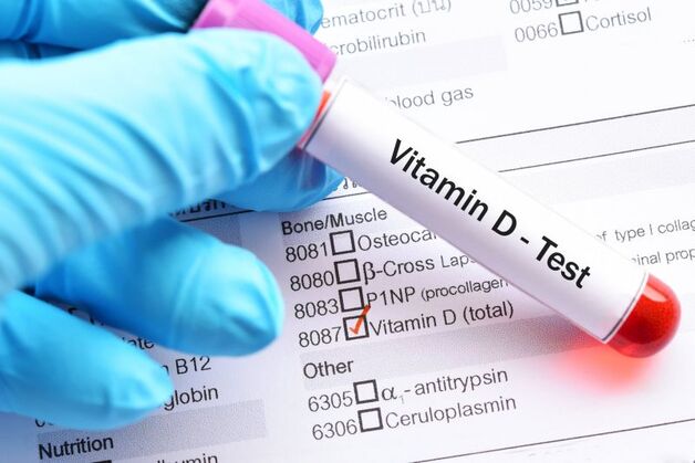 Xét Nghiệm Vitamin D3: Tầm Quan Trọng Và Lợi Ích Cho Sức Khỏe