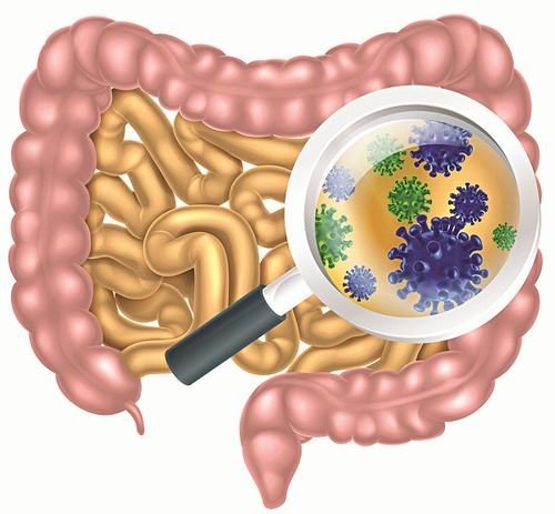 Nếu nhiễm các vi khuẩn đường ruột như salmonella và campylobacter sẽ làm tăng nguy cơ bị viêm đại tràng. Cả 2 loại vi khuẩn này đều có thể xâm nhập vào cơ thể thông qua thức ăn bị nhiễm bẩn, không được chế biến kỹ...