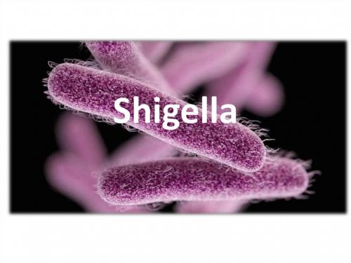 Bệnh lỵ trực trùng, hay còn gọi là lỵ trực khuẩn, hay bệnh kiết lỵ xảy ra chủ yếu do trực khuẩn lỵ Shigella