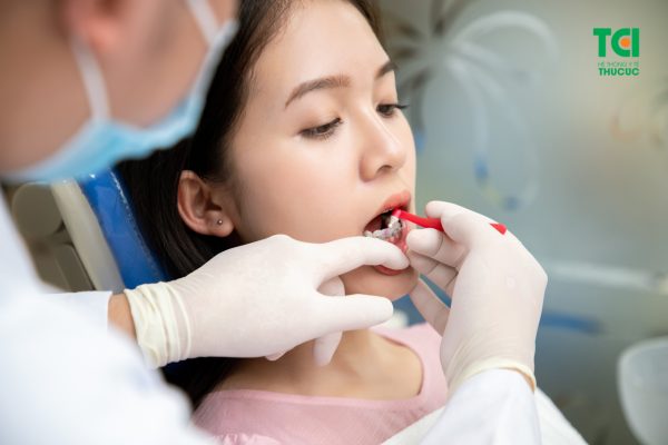 Niềng răng là phương pháp sử dụng các khí cụ nha khoa để giúp khắc phục những khuyết điểm của răng