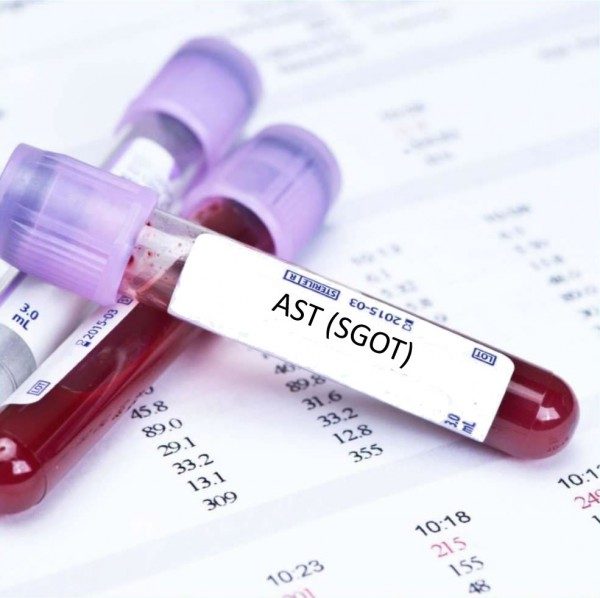 AST (Alanin Amino Transferase) là một trong 4 loại men gan (enzyme) đóng vai trò quan trọng trong phản ánh tình trạng của tế bào gan