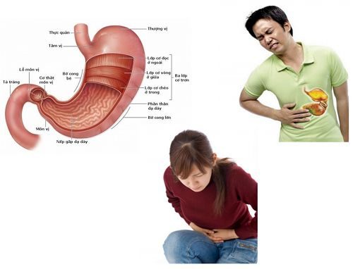 Đau vùng thượng vị, đau bụng là một trong những triệu chứng của bệnh dạ dày