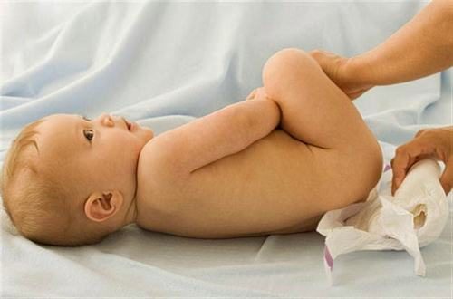 Bệnh rò hậu môn ở trẻ sơ sinh là do viêm nhiễm hoặc bẩm sinh